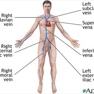 Dallas Varicose Removal - What To Consider Before Having Varicose Vein Procedures