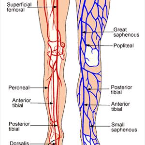 Vulvar Varicosities Treatment - Varicose Veins Treatment, Get Rid Of Varicose Veins